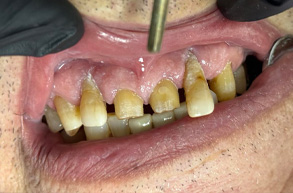 Smile Dental JC | Cosmetic Dentistry, Laser Dentistry and Night Guards