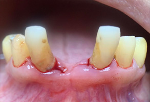 Smile Dental JC | Pediatric Dentistry, Sports Mouthguards and Air Abrasion