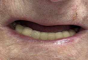 Smile Dental JC | Laser Dentistry, CBCT and Oral Exams